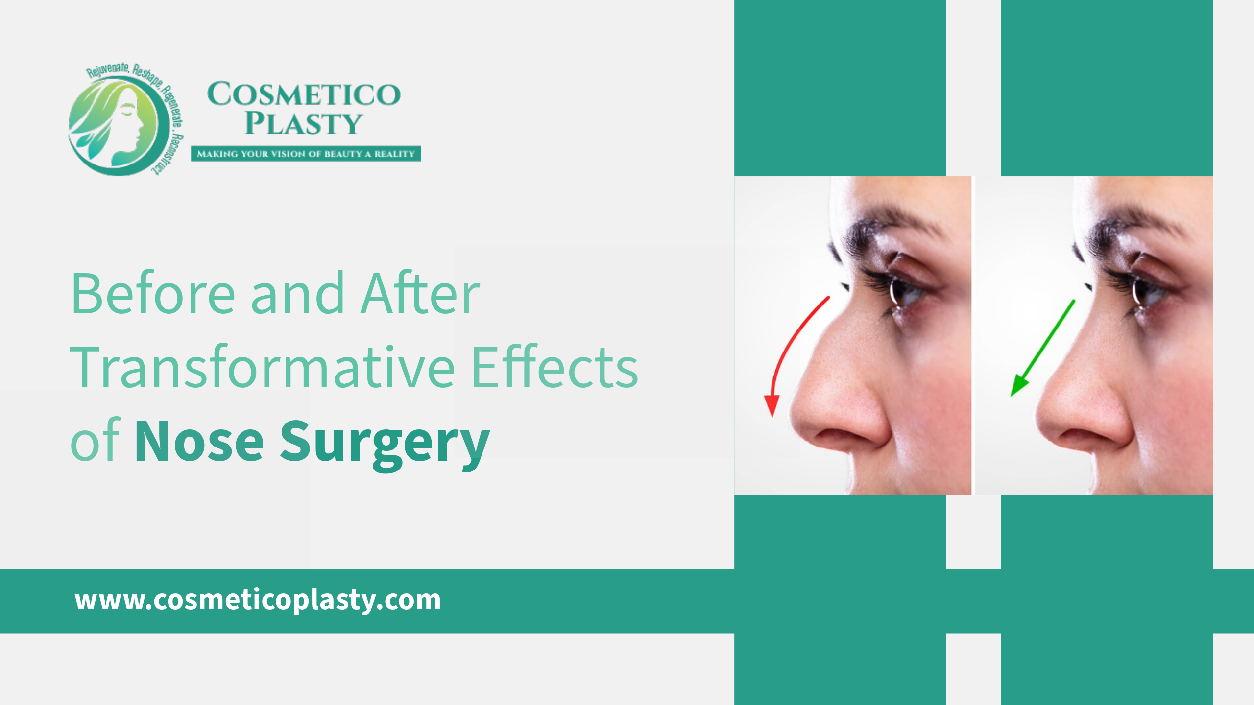 Before and After Transformative Effects of Nose Surgery
