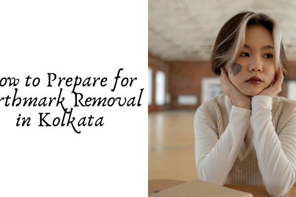 How to Prepare for Birthmark Removal in Kolkata