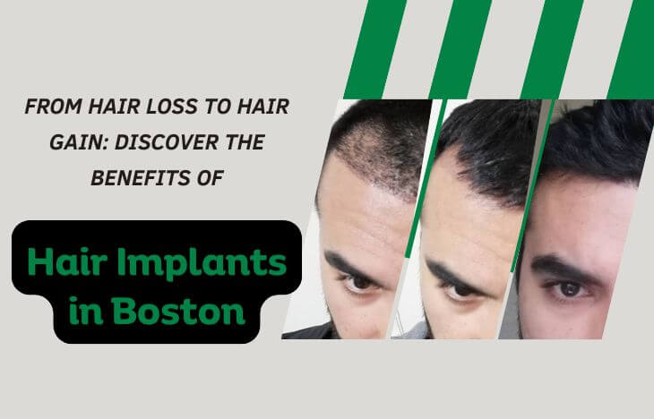 From-Hair-Loss-to-Hair-Gain-Discover-the-Benefits-of-Hair-Implants-in-Boston